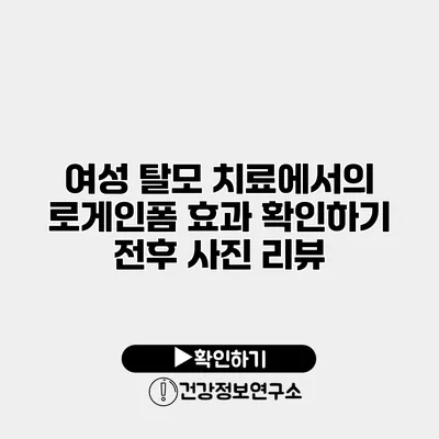 여성 탈모 치료에서의 로게인폼 효과 확인하기 전후 사진 리뷰